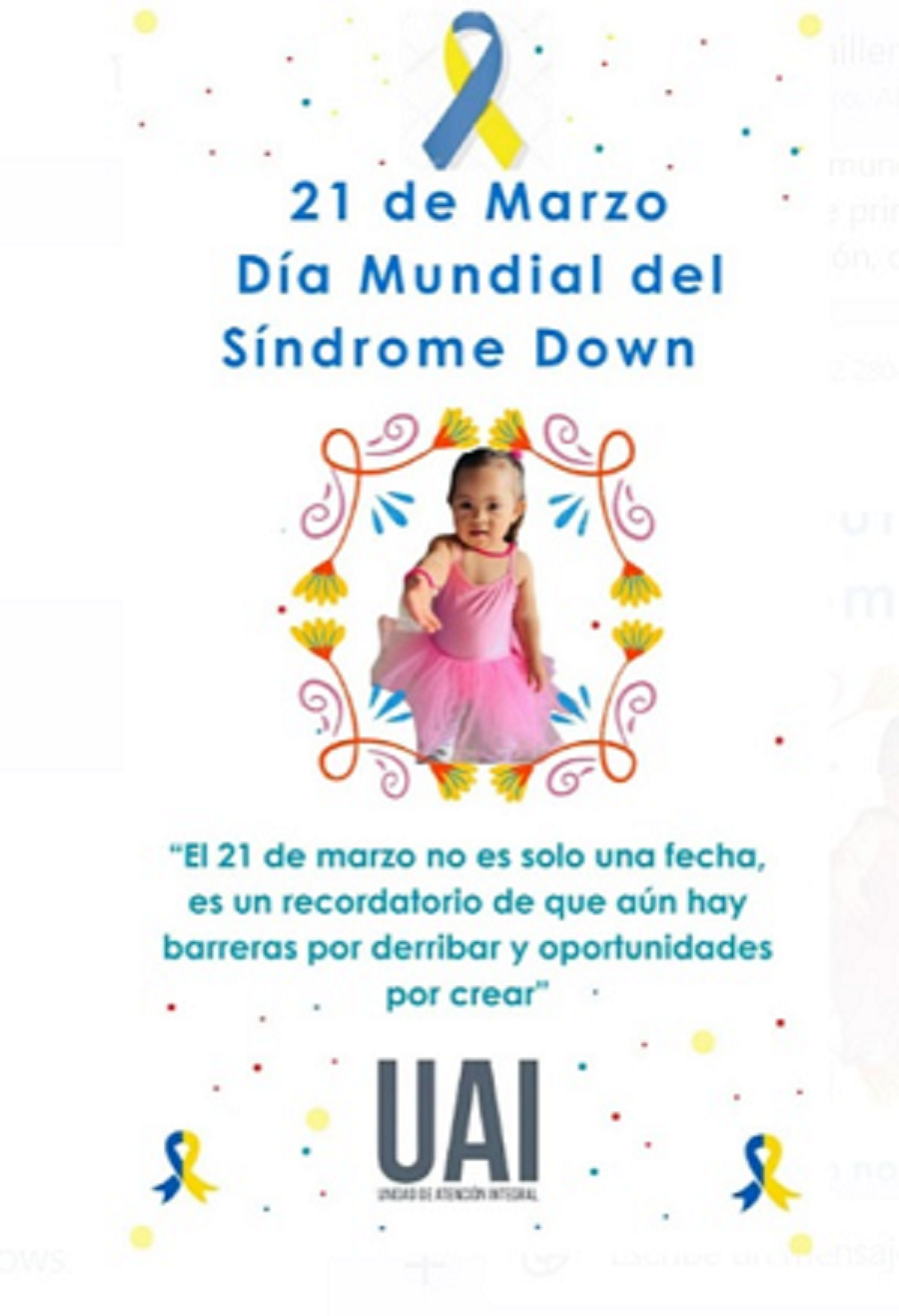 El síndrome de Down siempre ha formado parte de la condición humana.